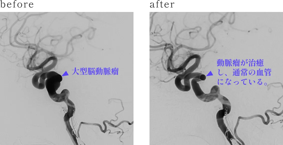 Before After